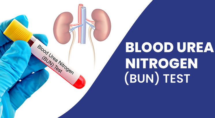 blood urea nitrogen test (BUN)